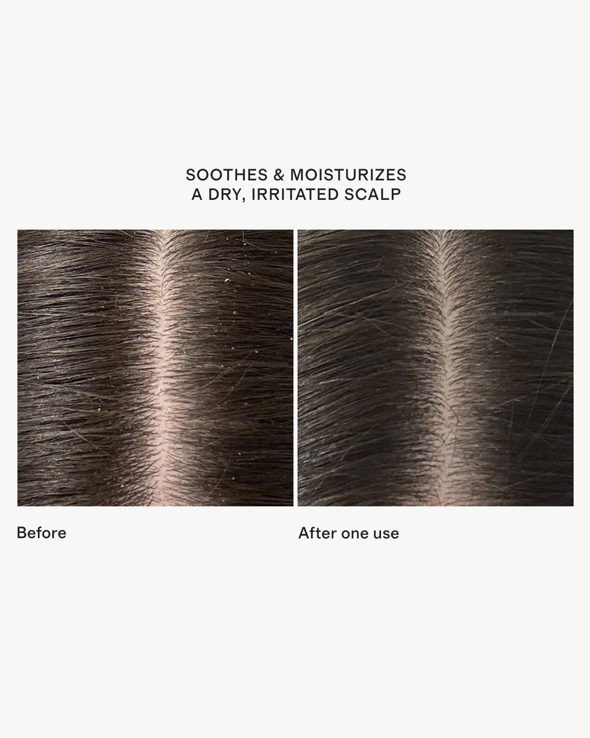 Briogeo Scalp Revival Pre-Wash Oil - Thumbnail 4