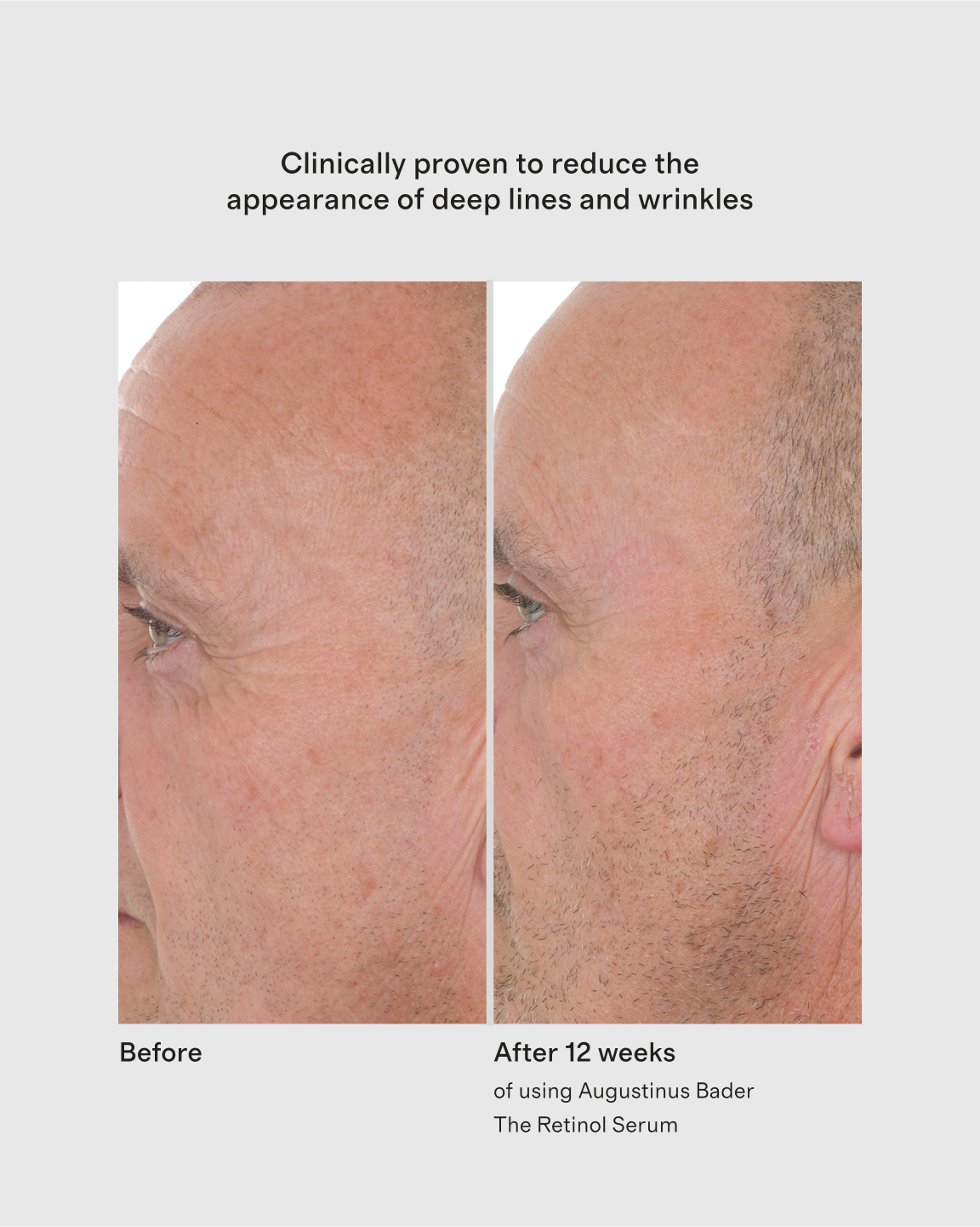 The Retinol Serum by Augustinus Bader 30ml - thumbnail 4
